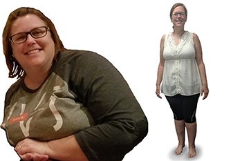 Photos of Beth Gasser before and after bariatric surgery 