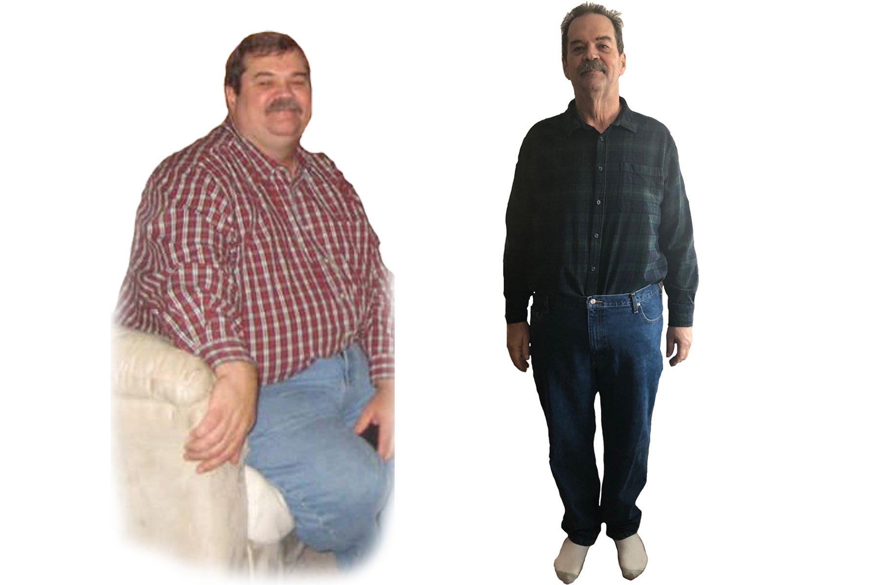 Before and after photos of Brian Nelsen, bariatric patient