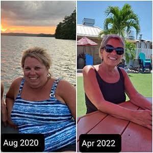 Before and after photos of Terry Hennen, bariatric patient